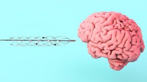 Quali sono le interfacce cervello-computer, la tecnologia che Elon Musk vuole portare alle masse con Neuralink?