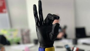 "Armi da eroe": ai soldati ucraini feriti vengono fornite armi bioniche ad alta tecnologia