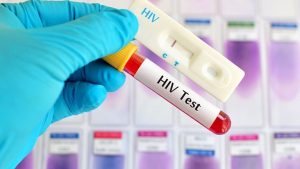 "Paziente di Düsseldorf": una terza persona libera dall'HIV significa che abbiamo finalmente trovato una cura?