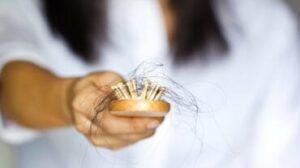 la perdita di capelli
