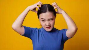 cuoio capelluto secco