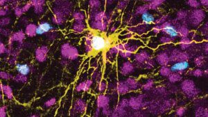 Gli scienziati coltivano "mini cervelli" umani in ratti per studiare disturbi come autismo e schizofrenia