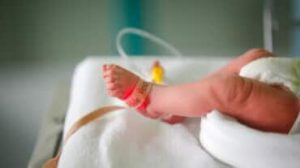 neonati prematuri