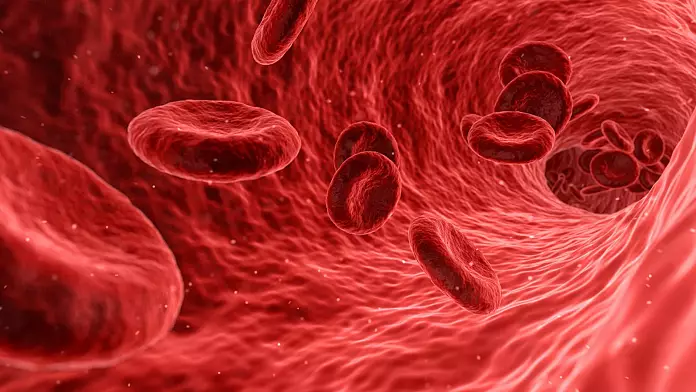 Una prima sperimentazione al mondo sul sangue coltivato in laboratorio potrebbe rivoluzionare le trasfusioni per i pazienti con anemia falciforme