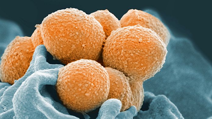Gli scienziati hanno scoperto un anticorpo chiave che potrebbe produrre nuovi trattamenti contro lo streptococco A