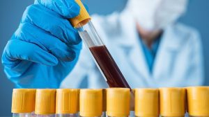 L'Inghilterra guida la corsa per eliminare l'epatite C, anni prima degli obiettivi globali