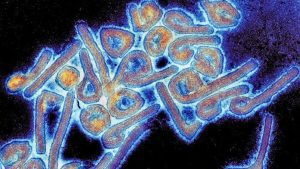 Cos'è il virus Marburg, la mortale malattia simile all'Ebola che scoppia nella Guinea Equatoriale?