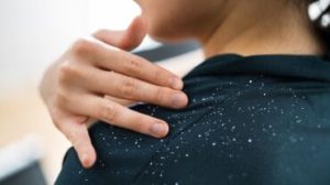 Health Shots ha contattato il dottor Rinky Kapoor, consulente dermatologo, dermatologo cosmetico e dermato-chirurgo, The Esthetic Clinics per capire se l'oliatura dei capelli è un modo per ridurre la forfora o meno.