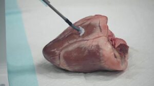 Questo minuscolo robot potrebbe stampare in 3D all'interno del tuo corpo per effettuare riparazioni e combattere il cancro