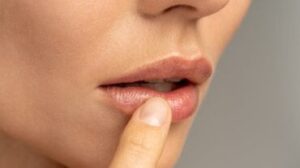 labbra screpolate vs labbra bruciate dal sole