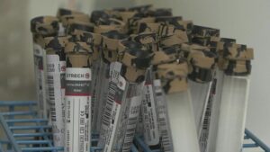 Gli scienziati danesi sviluppano un esame del sangue precoce che potrebbe scoprire la vera causa di un aborto spontaneo