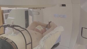 I medici stanno colpendo il cuore con radiazioni nel tentativo di curare una causa comune di arresto cardiaco