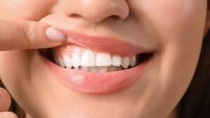 I problemi gengivali possono causare mal di denti