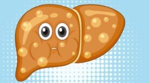 invertire il fegato grasso con la dieta giapponese