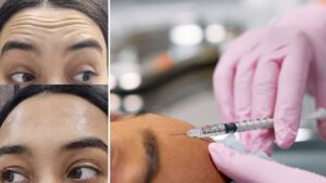Turismo medico: le cliniche botox economiche della Corea del Sud sono un affare di bellezza o i prossimi "denti da tacchino"?