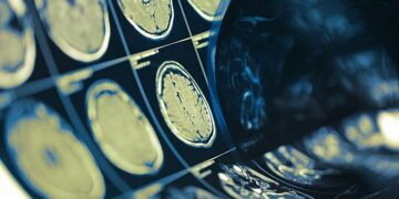 Un chip cerebrale può leggere le menti delle persone con una precisione fino al 74% 5 Un chip cerebrale può leggere le menti delle persone con una precisione fino al 74%